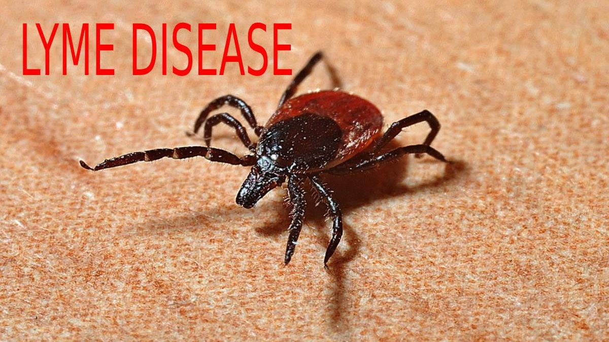 Lyme Disease – Causes, Symptoms, Diagnosis & Treatment
