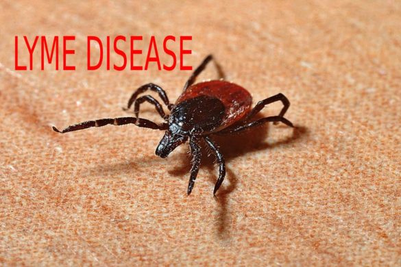 Lyme disease