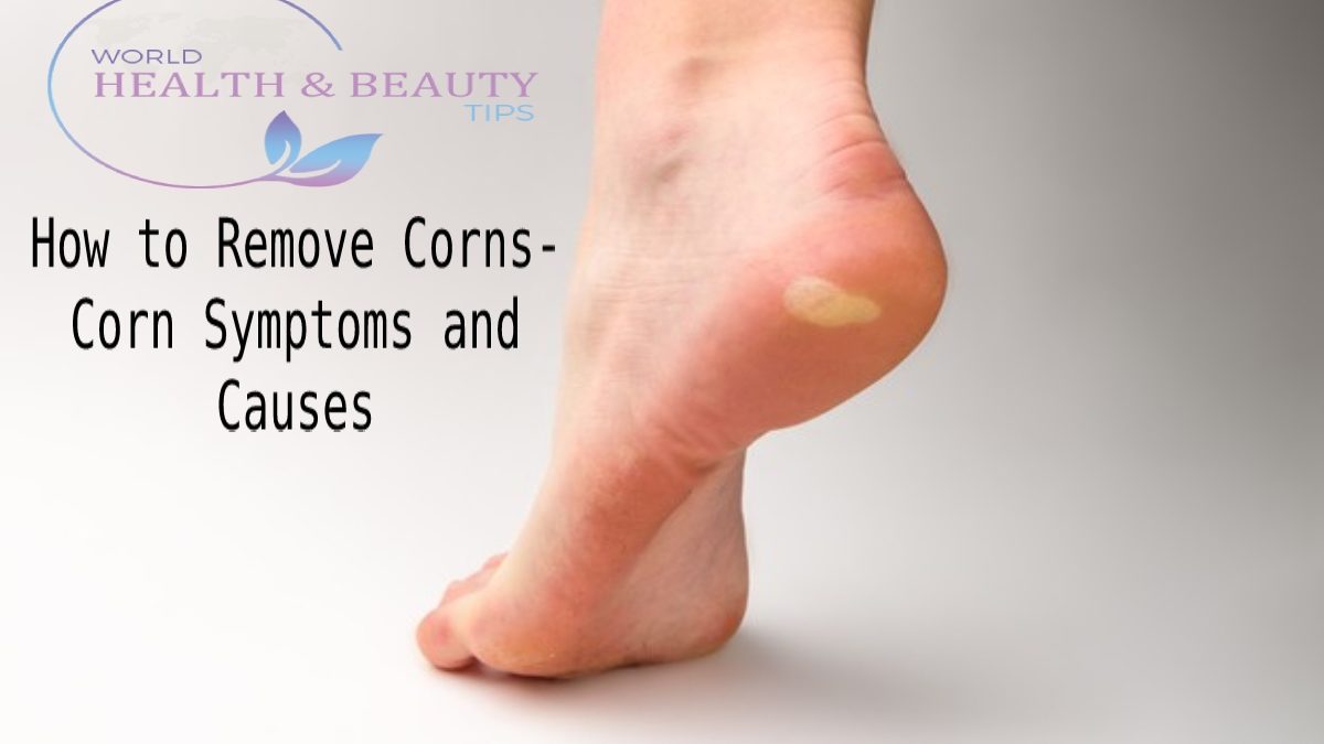 How to Remove Corns- Corn Symptoms and Causes